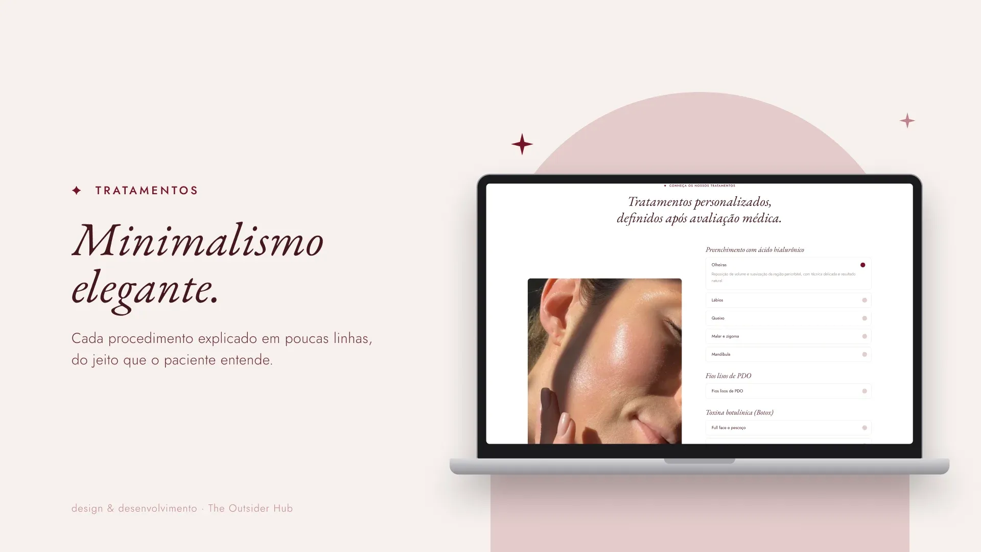 Slide “Minimalismo elegante.” com os tratamentos no computador
